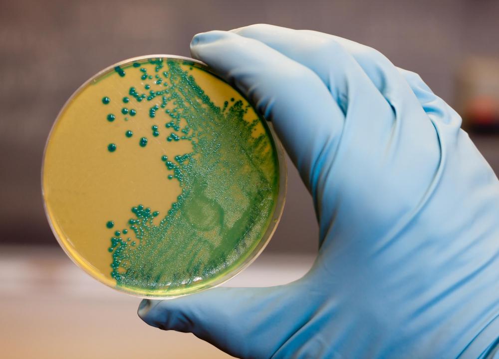 Microbiologist study Listeria bacteria in a Petri dishes.