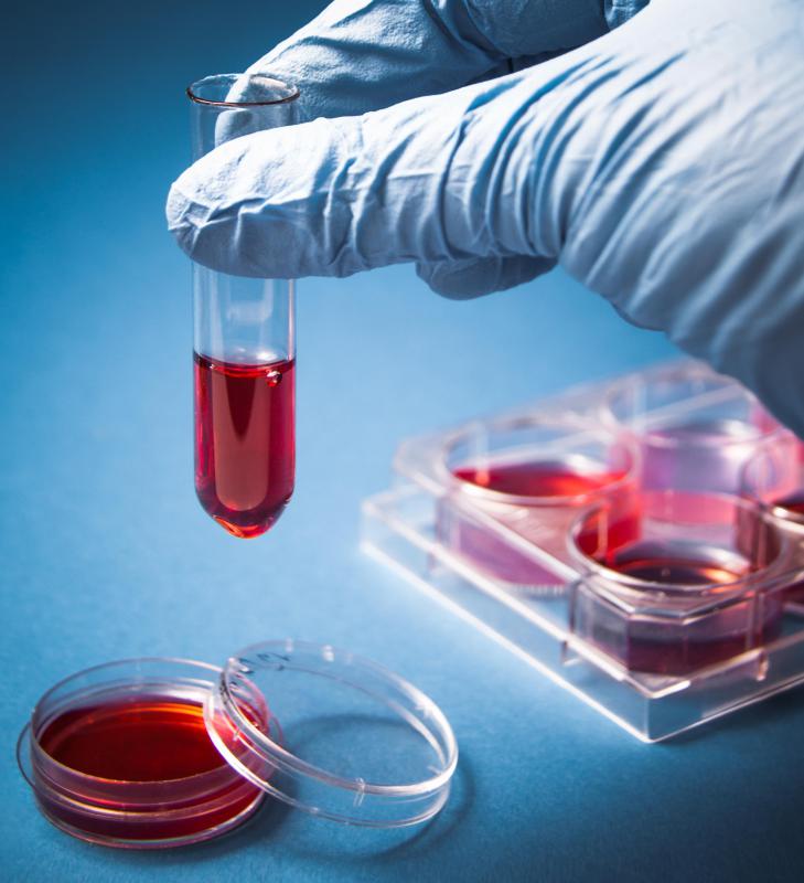 A forensic toxicologist may analyze blood for evidence of drug use.