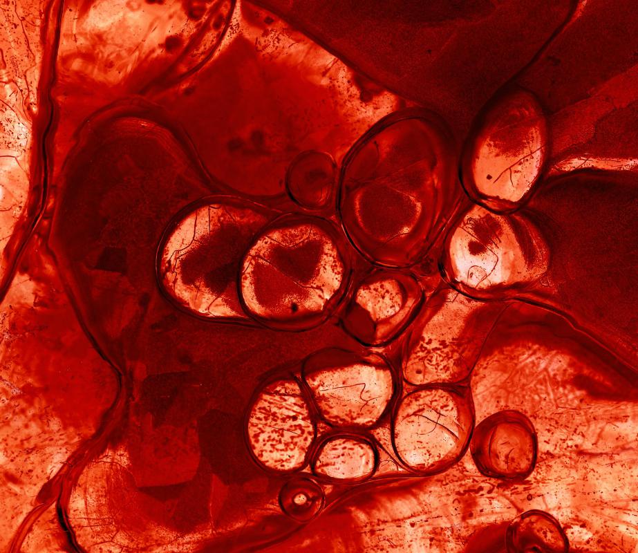 Pulmonary circulation is the movement of blood from the heart, to the lungs, and back to the heart again.