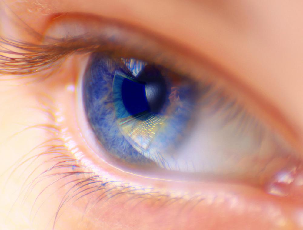 A prosthetic eye does not restore vision loss.