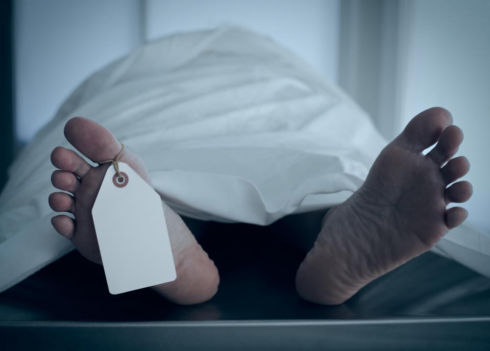 A morgue attendant might assist a pathologist in an autopsy.