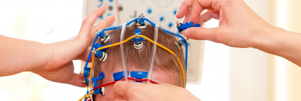 A physiologist may study things like electroencephalography (EEG) tests and nerve conduction studies to assess the brain's response and make recommendations about care.