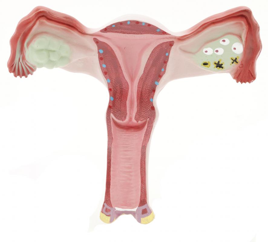 An intrauterine pregnancy occurs when a fertilized egg implants itself on the interior wall of the uterus.