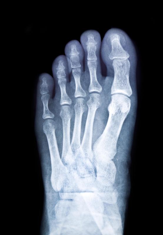 Most podiatrists' offices will be able to take x-rays of an injured foot.