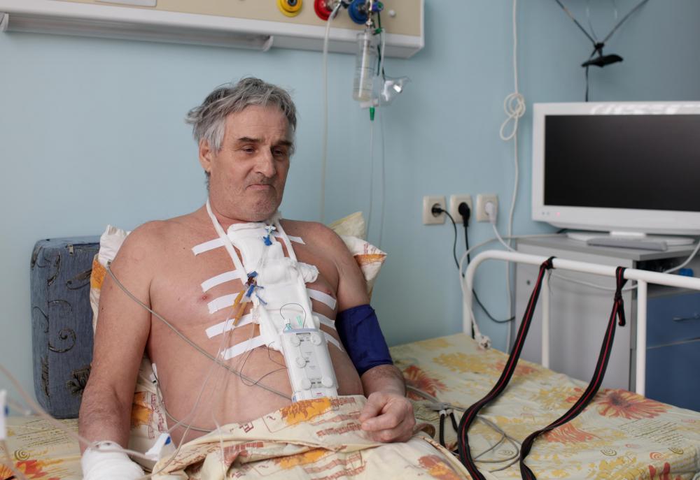 A sternotomy is a thoracic surgery that cuts through the breastbone.