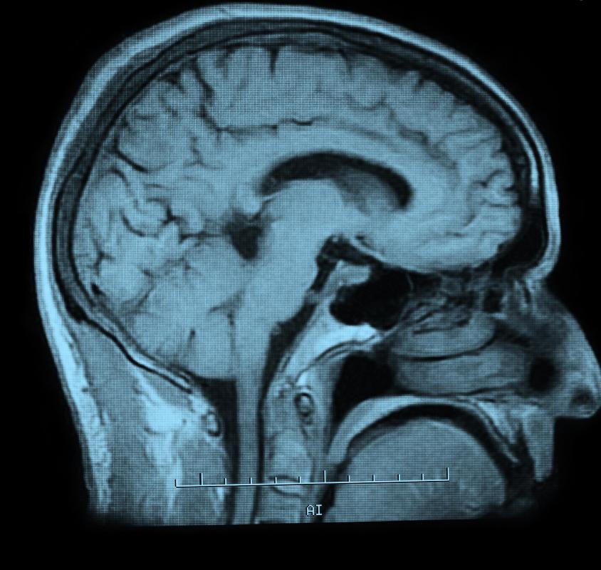A neuroscientist will be able to interpret brain scans and check for any abnormalities.