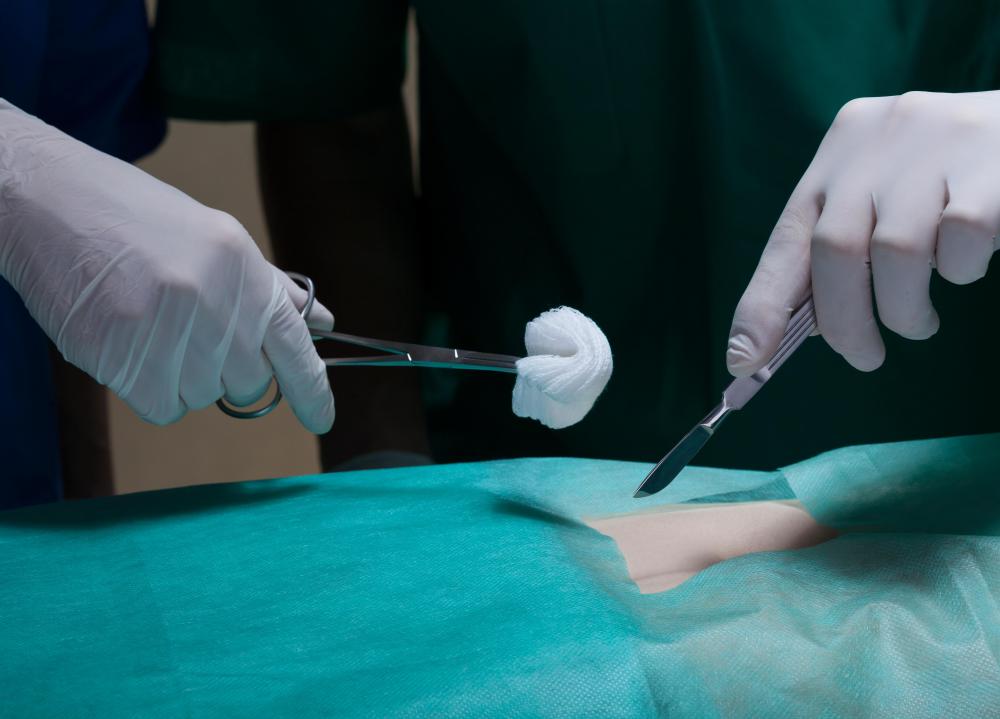 A medical photographer may take photographs of surgical procedures.