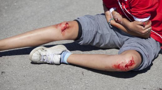A treatment nurse may address skin wounds that are a result of trauma.