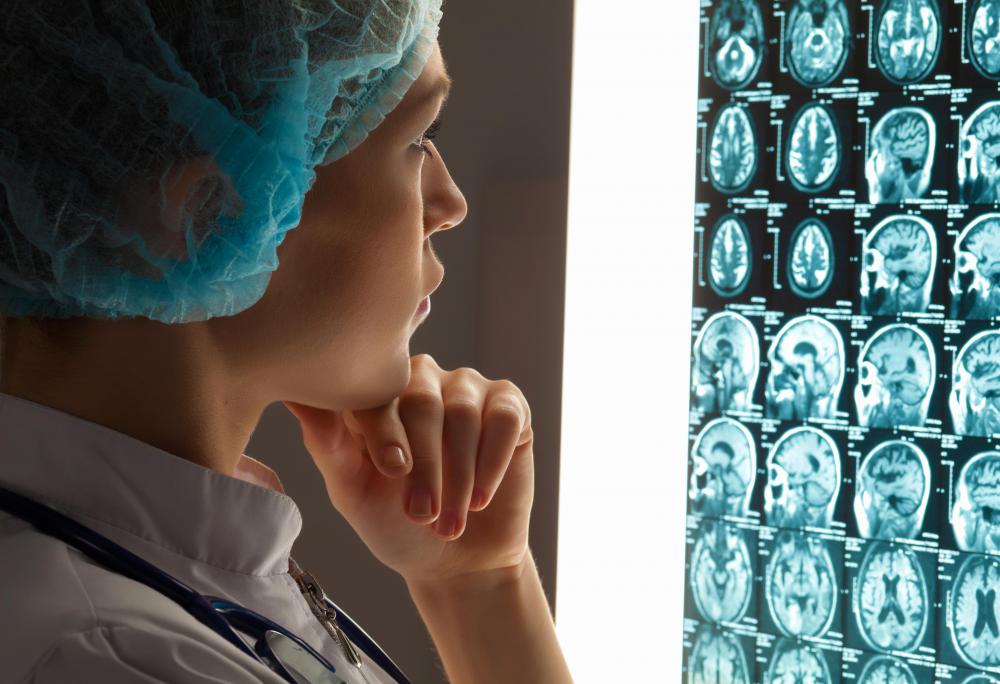 Neurosurgeons spend lots of time studying patients' files, analyzing MRI scans and other images of the brain.