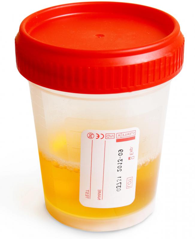 Forensic toxicologists often work with urine.