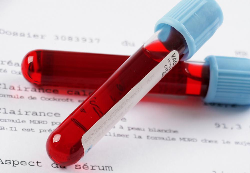An LVN may have to collect blood samples from patients.