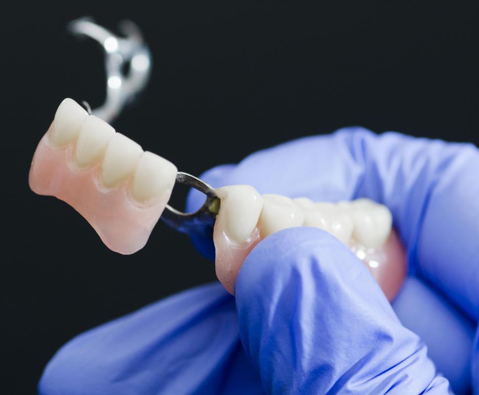 What does a Dental Ceramist do? (with pictures)