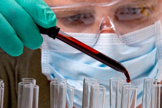 A hematologist performing lab research with a blood sample.