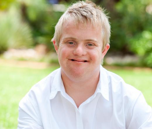 A pediatric physical therapist may work with people with Down's syndrome.