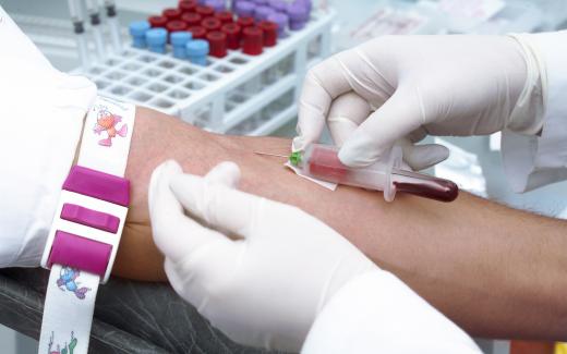 An LPN or licensed practical nurse must know how to draw blood from patients.