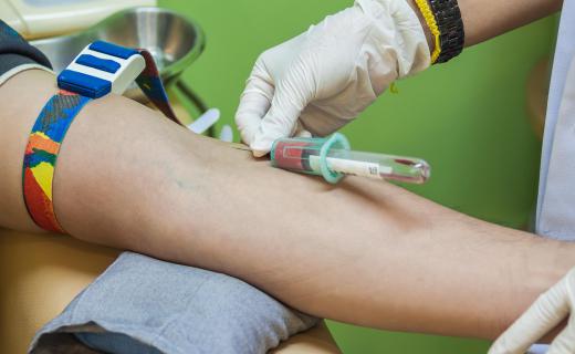 A dermatology assistant may have to help with minor procedures such as drawing blood.