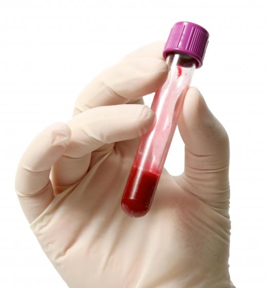 Some laboratory technicians test blood samples.