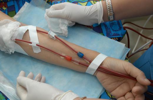 Common hematology treatments can include blood transfusions.