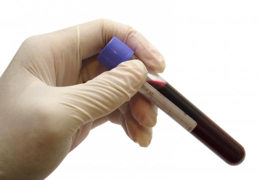 A medical technician may take blood samples.