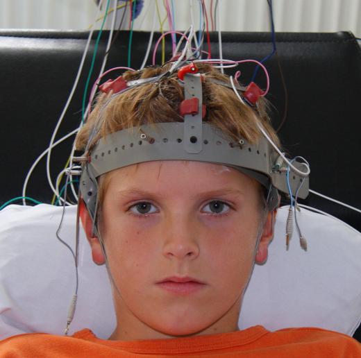 A boy connected to an EEG machine, which provides biofeedback.