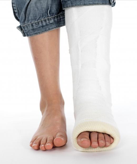 An orthopedist may diagnose and care for patients with broken bones.