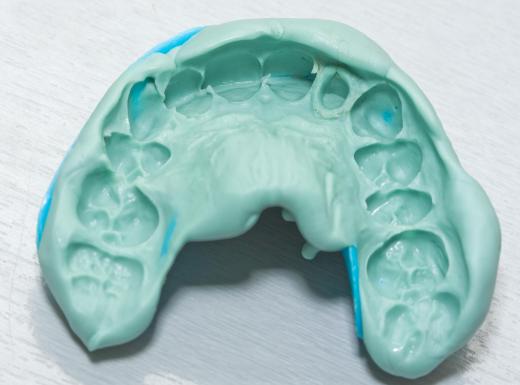 In prosthetic dentistry, dentists often make impressions of the teeth to create dentures, crowns, bridges and implants.