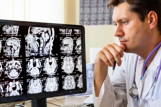 Interventional neurologists rely heavily on imaging to plan and perform procedures.