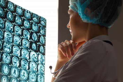 A neuroscientist studies a patient's brain scans.