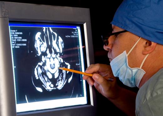 Neurosurgeons in some jurisdictions may earn commissions or receive incentive payments.