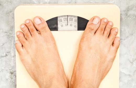 Bariatric surgery typically leads to weight loss.