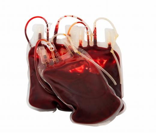 Laboratory consultants may work at blood banks.