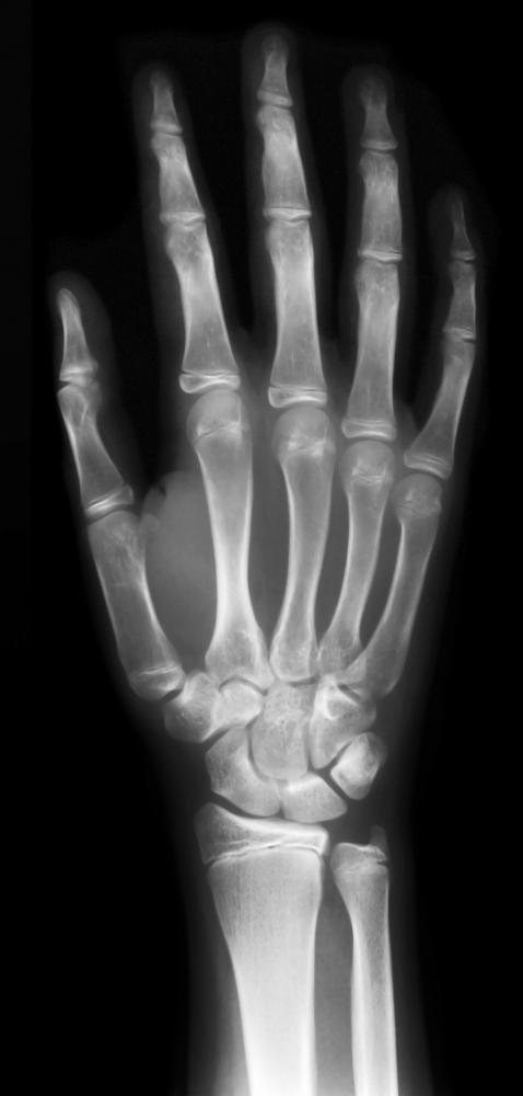 An X-ray taken by a diagnostic radiographer.