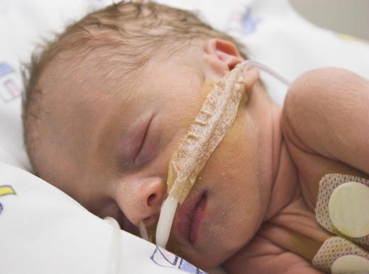 Neonatal doctors are well-trained to care for critically ill newborns.