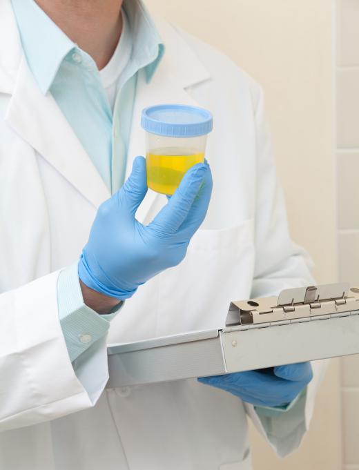 A lab assistant holding a urine sample.