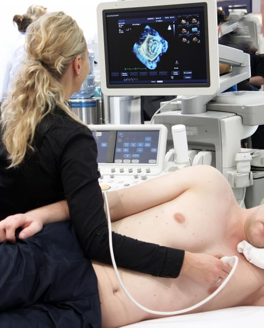 An echocardiographer uses sonogram technology to provide imaging of the heart.