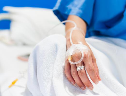 IV nursing is the nursing of patients who need intravenous therapy.