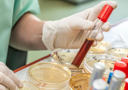 A biological anthropologist might work in a lab testing various cell and tissue samples.