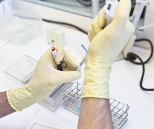 A phlebotomist must know how to properly handle samples until they can be delivered to a laboratory technician for blood testing.