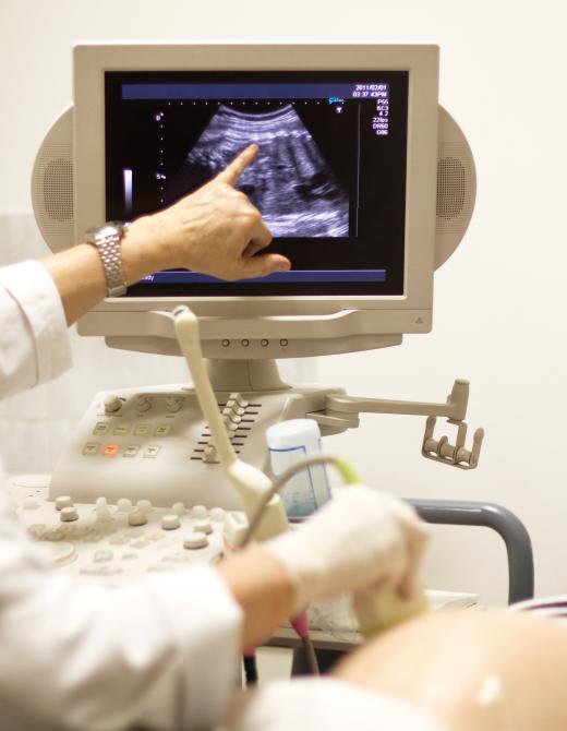 Pregnant women often undergo ultrasound scans.