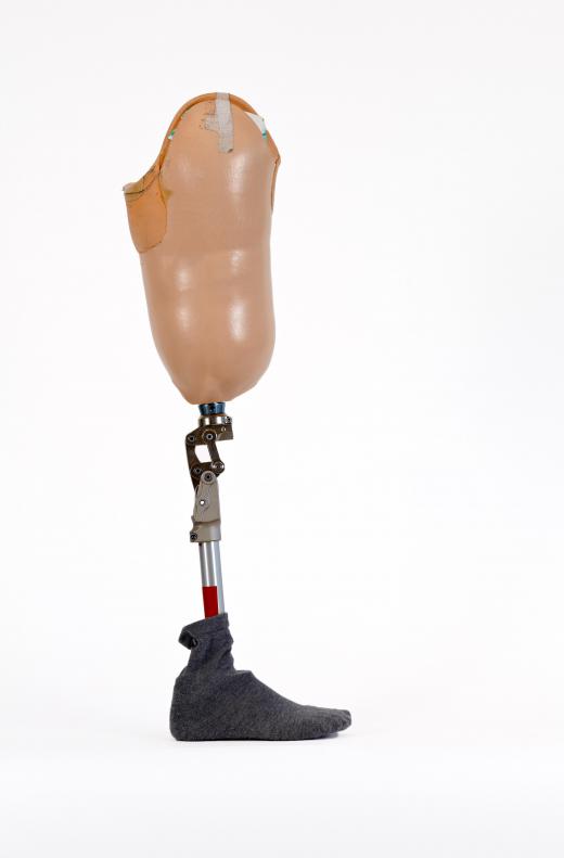 Rehabilitation nurses may work with patients adjusting to the use of a prosthetic limb.