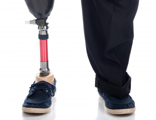 Prosthetic technicians must be experts on building, fitting, and repairing prosthetic limbs.