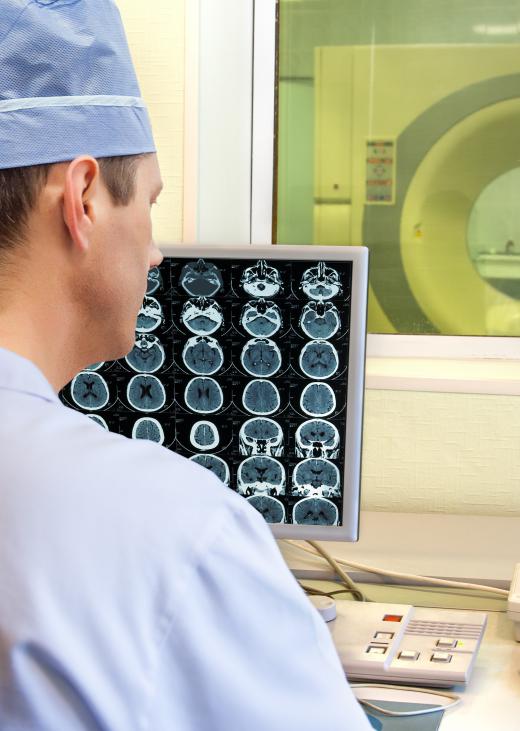 Neurologists rely on sophisticated brain imaging to help diagnose diseases and conditions.