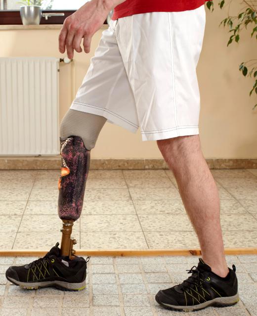 Podiatrists are often tasked with fitting and monitoring leg and foot prosthesis.