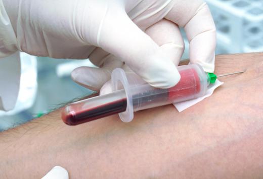 Paramedical examiners often must hold a phlebotomy certification, since blood samples are frequently required.