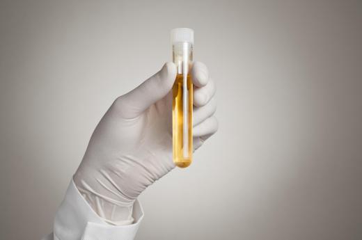 Pediatric nurses may be responsible for collecting urine samples.