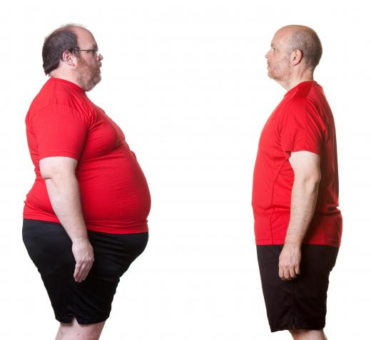 A weight loss consultant helps motivate an individual to lose weight.