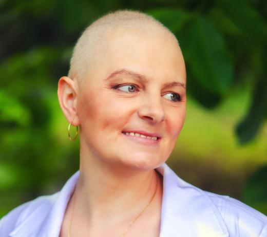 Radiation therapy may cause hair loss.