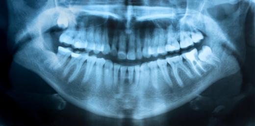 An orthodontic assistant may help administer dental x-rays.