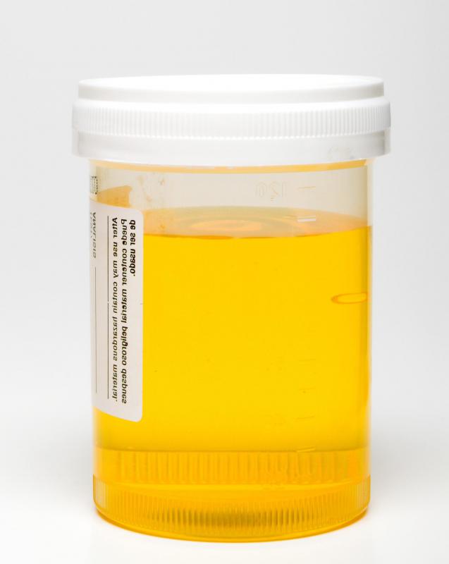 What is a Pediatric Medical Assistant? (with pictures)